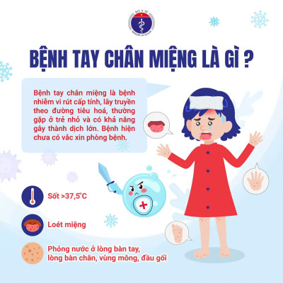 Một số lưu ý về cách phòng bệnh tay chân miệng hiện nay